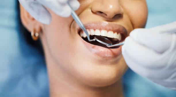 Best Emergency Dental Care for Abscessed Tooth in Belle Fourche, SD