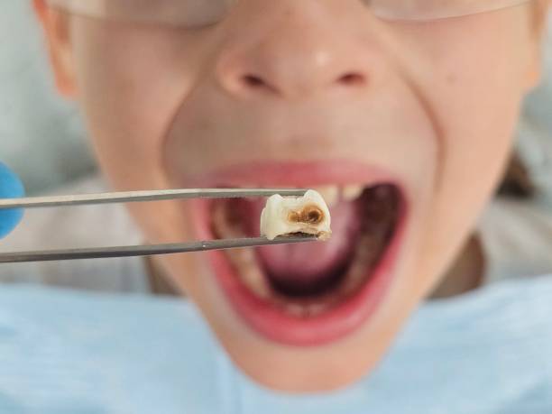 Best Emergency Dental Services for Seniors in Belle Fourche, SD